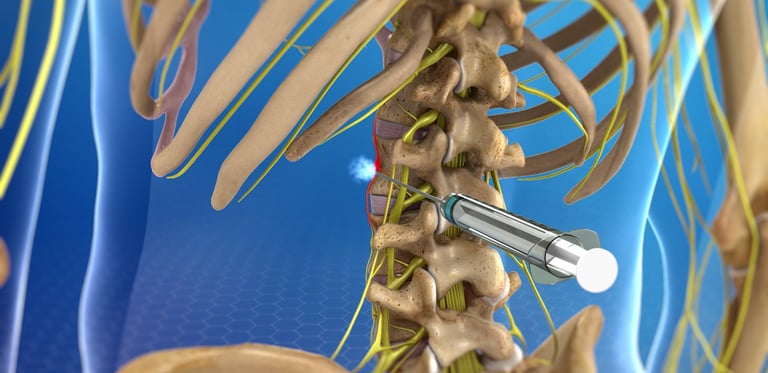 Dr.Rajinikanth's ortho clinic nerve block