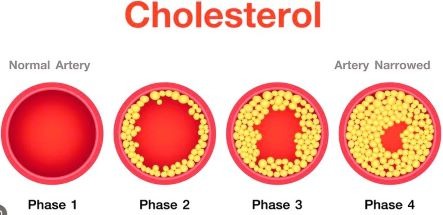 cholesterol