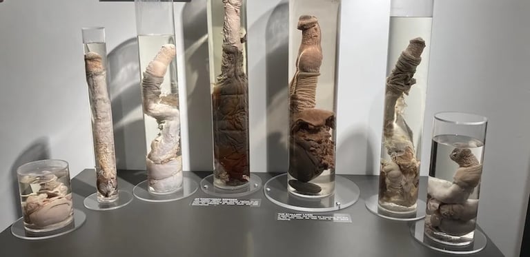 Anatomical specimens of whale penises preserved in liquid-filled glass jars at the Icelandic Phallological Museum.