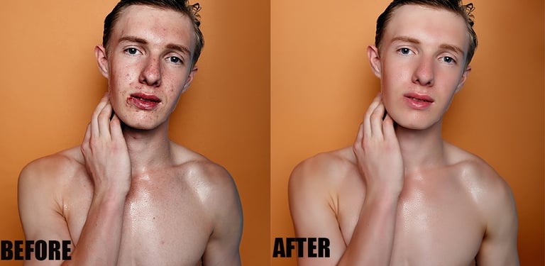high-End skin retouching 
