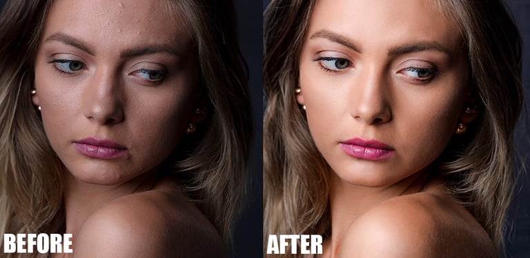 Skin Refinement 