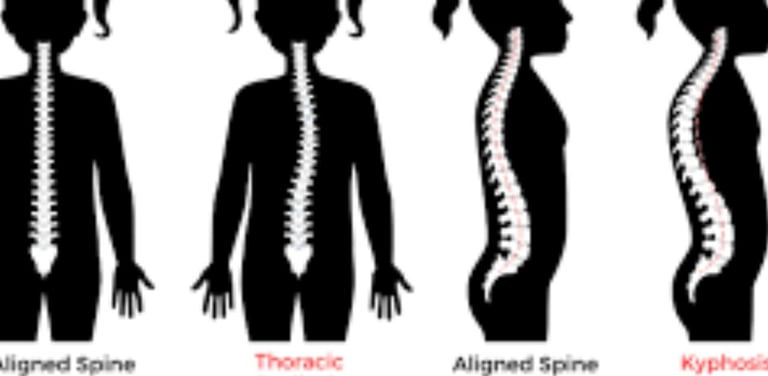 🦴❄️ Kyphosis and Kyphoscoliosis The Only Hope – Cold Water & Fasting Therapy 🍽️💧