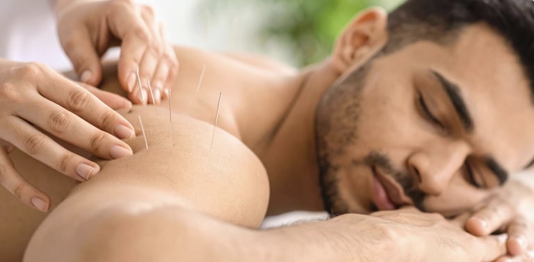 Acupuncture in Temecula California
