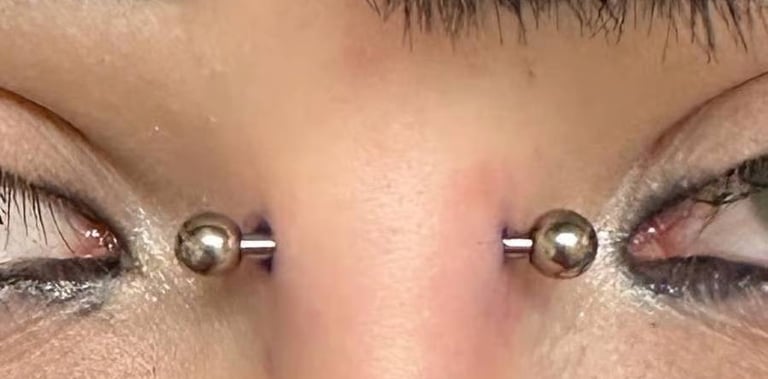 A close-up of a symmetrical bridge piercing with titanium barbells. The jewellery sits evenly across