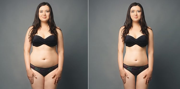 body-reshaping
