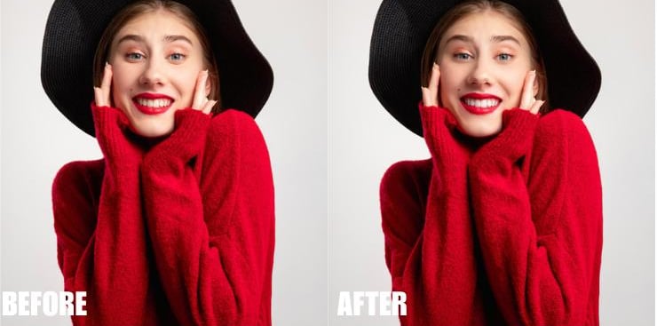 teeth-whitening-and-eye-enhancement