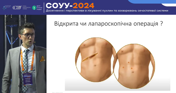 хірург-уролог, онкоуролог Олександр Стаховський, уролог, рак нирки, операції на нирці, лапароскопія