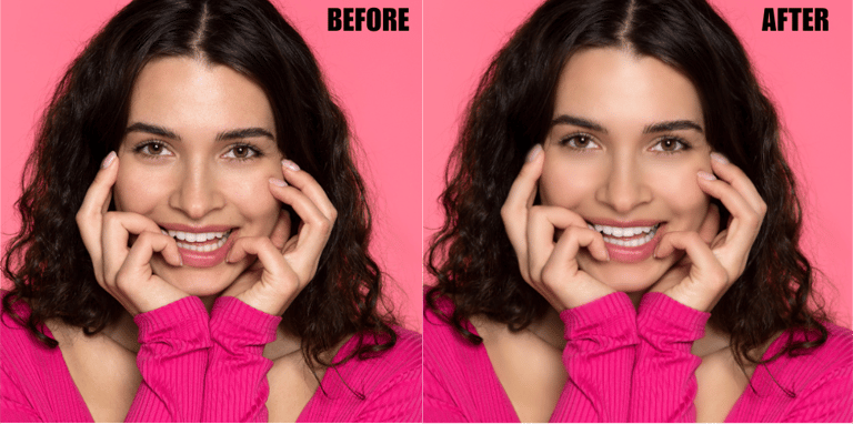 teeth-whitening-and-eye-correction