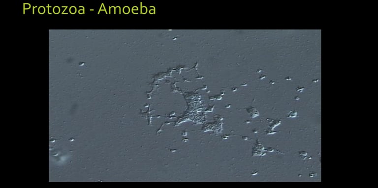 microscope image of a living Soil Amoeba