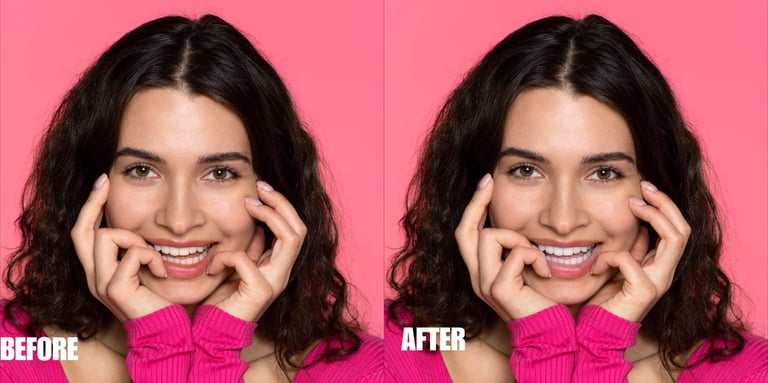 teeth-color-correction