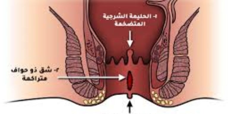 healing processes by reducing inflammation and providing a rest period for the digestive system.
