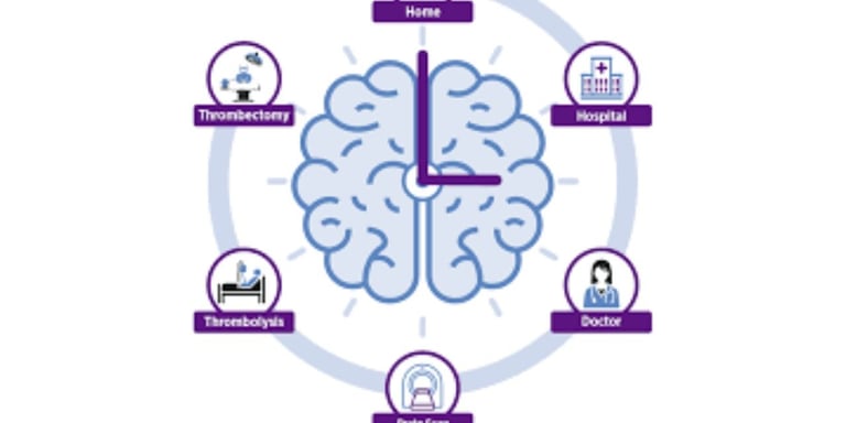 time is brain