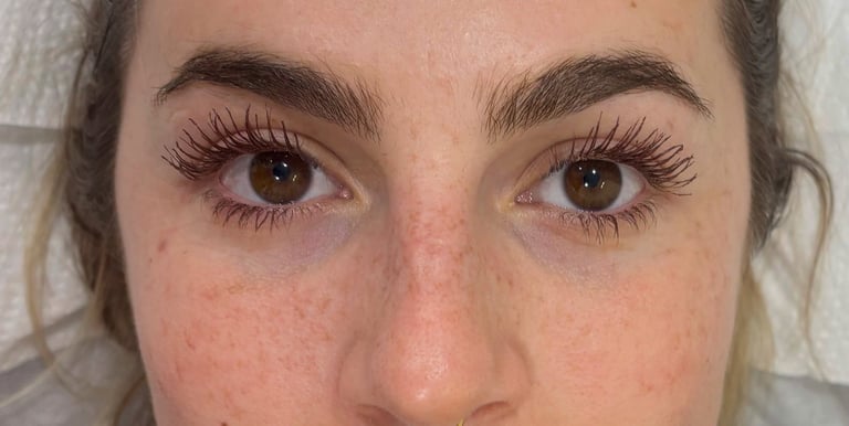 Taches de rousseur semi permanente résultat 1ère pose nez + pommettes sans retouche