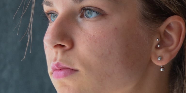piercing e furo de orelha humanizado