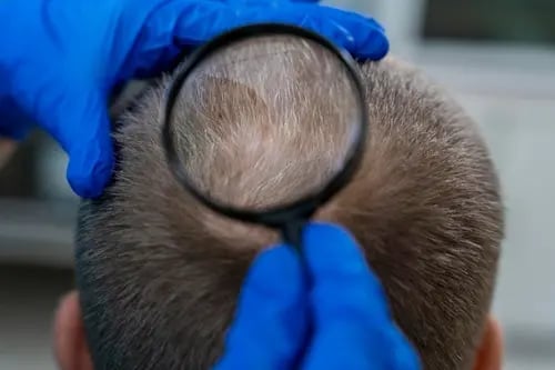 a man with a magnifying magnifying a magnifying magni