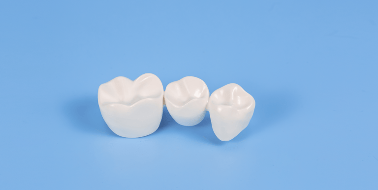 example of a dental bridge