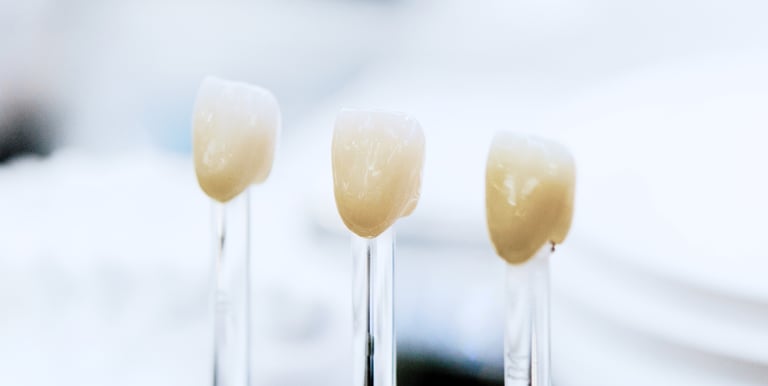 example of dental crowns