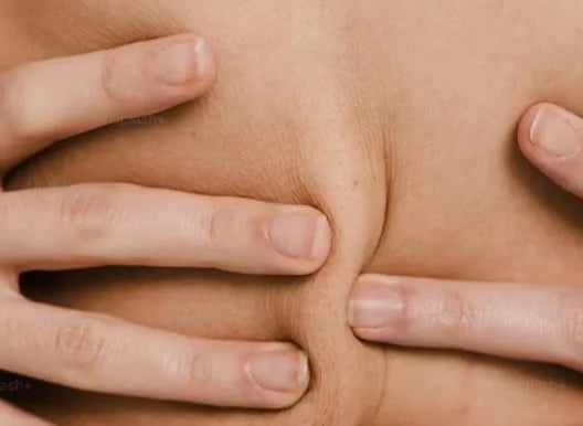 melanin production support