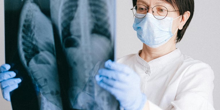 health insurance - a doctor observing a x ray report of a patient