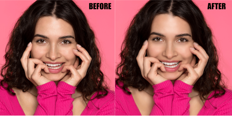 teeth-whitening-and-eye-correction