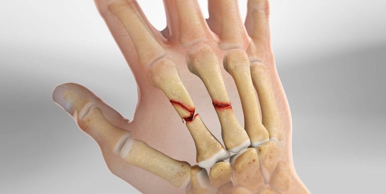 Dr.Rajinikanth's ortho clinic hand fracture