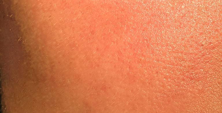 Skin showing some redness or irritation.
