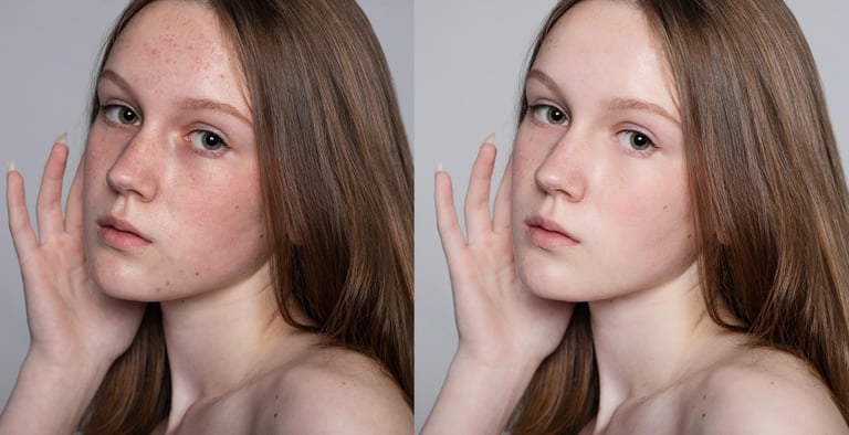 blemishes-and-scars-removal