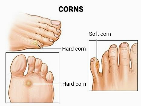 Vetrivel Health center best chiropractic and varamam theraphy 