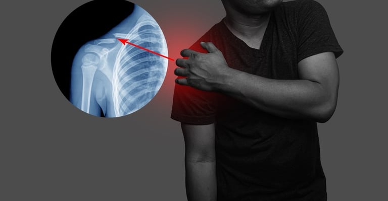 Dr.Rajinikanth's ortho clinic shoulder dislocation