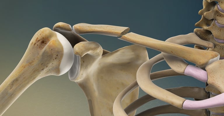 Dr.Rajinikanth's ortho clinic shoulder fracture