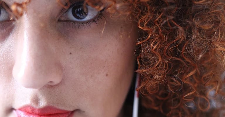 Melasma treatment at Ariana Esthetic Edmonton