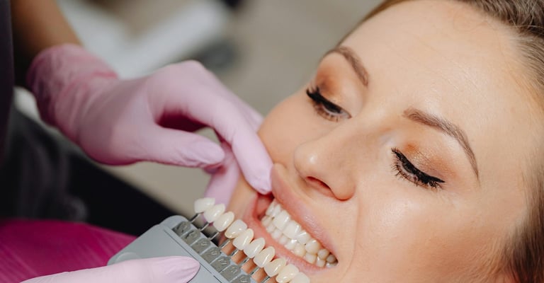 Best Dentist for Veneers in Naples FL — Dr. Kristina Taranov DDS Cosmetic Smile Specialist