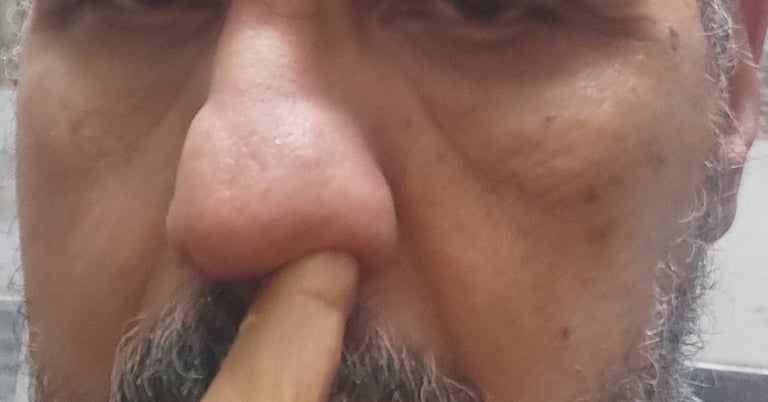 علاج الانف