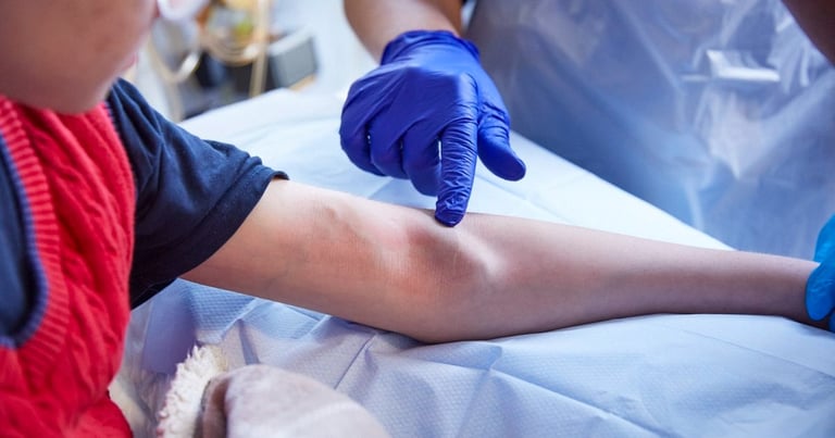 haemodialysis bruit avf dialysis disease artery vein arteriovenous fistula diabetes kidney failure renal vascular ultrasound