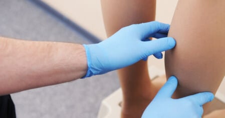 vascular ultrasound vein bypass graft mapping artery blockage occlusion surgery superficial leg arm pain walking ache calf