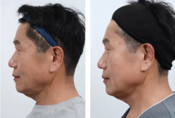 a man with a black headband and a black headband