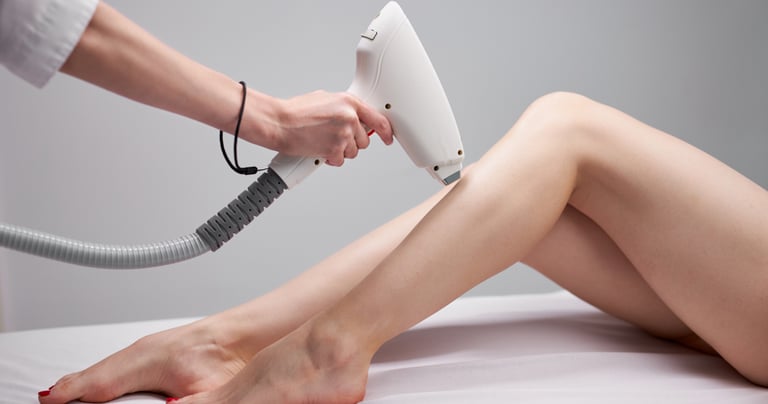 epilare definitiva IPL Timisoara