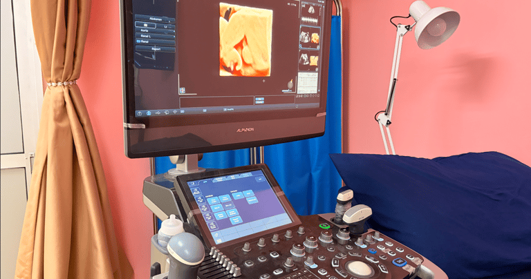 Professional 4D ultrasound machine in a clinic displaying a prenatal baby scan on the monitor.