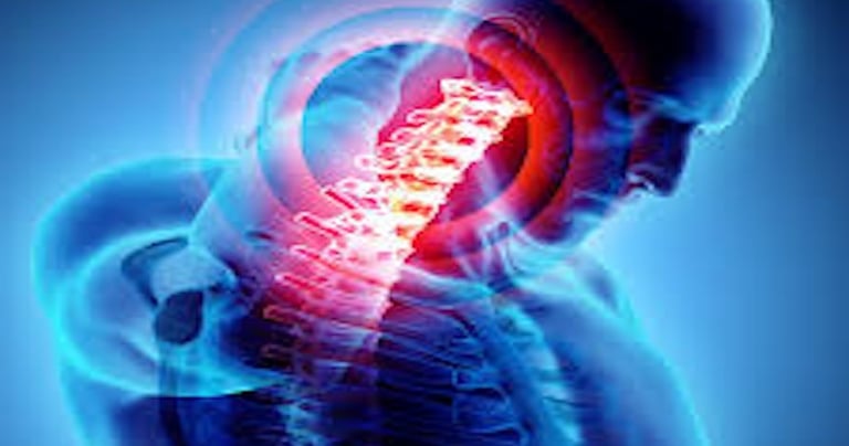 CERVICALGIA E BRACHIALGIA DALLA COLONNA CERVICALE