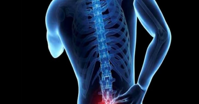 LOMBALGIA O SCIATICA DALLA COLONNA VERTEBRALE