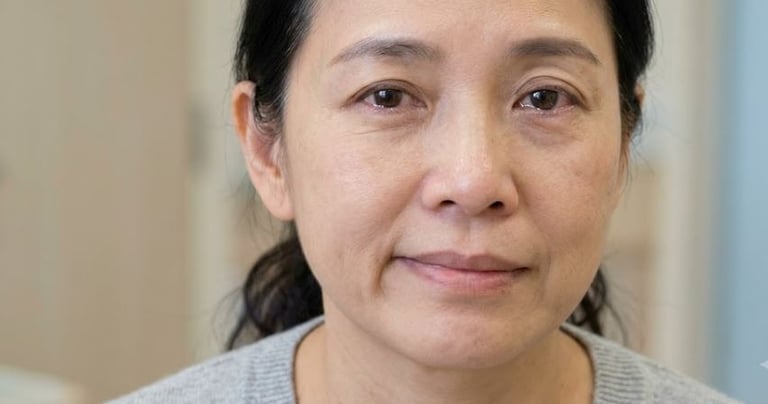 Acupuncture for Bell's Palsy in Arcadia