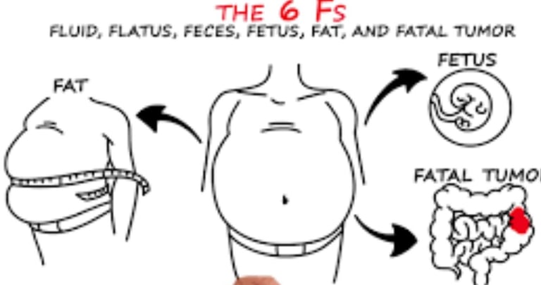 انتفاخ البطن : مجموعة متنوعة من العلاجات the 6 fs
