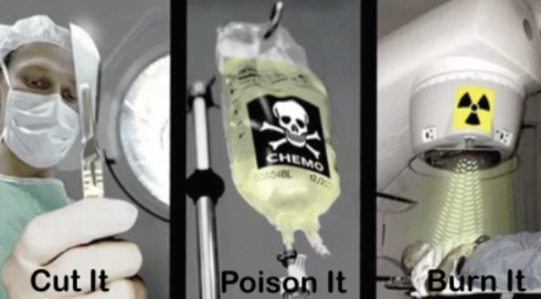 Modern fight against cancer: cut it, poison it, burn it