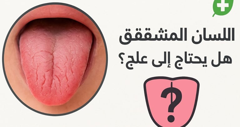 ⚕️🌿 اللسان المتشقق هل يحتاج إلى علاج؟👅❓ (2)