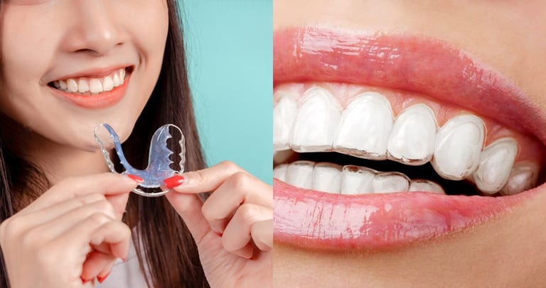 alineadores invisibles y metalicos