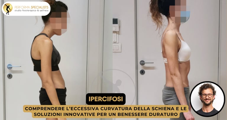 Correzione ipercifosi e miglioramento cifosi Performa Specialists By Dott. Alessandro Rossin