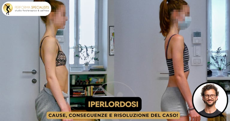 Trattamento dell'iperlordosi lombare con Performa Specialists by Dott. Alessandro Rossin