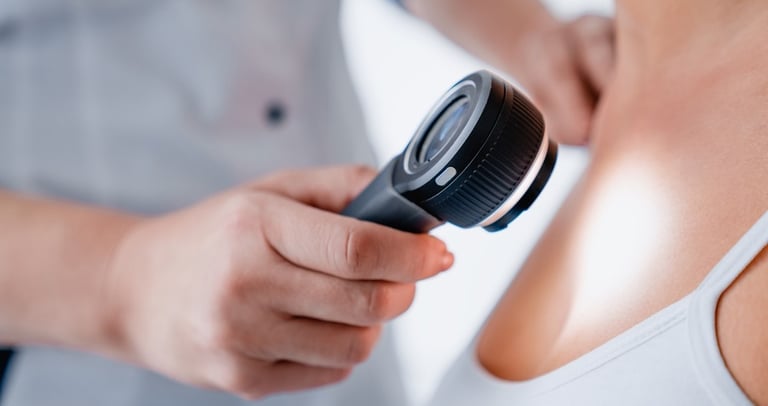 Specialist assessment of skin lesions and moles using Dermatoscopy.