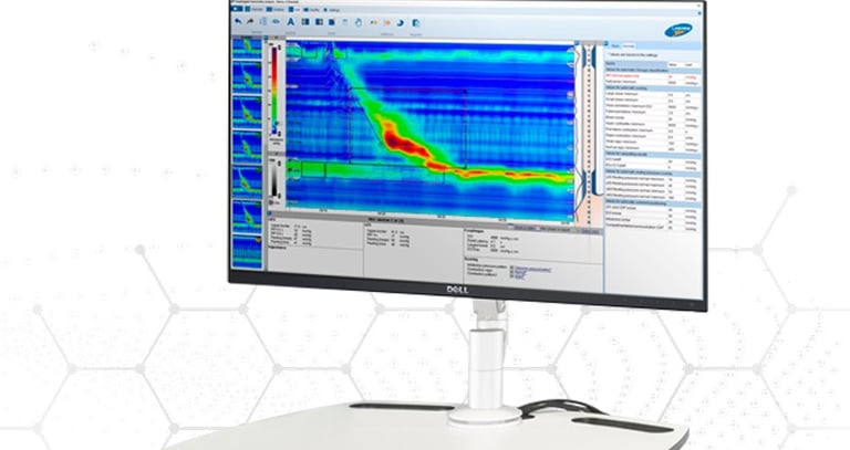 esame-per-la-muscolatura-ano-rettale-per-verificarne-la-funzionalità