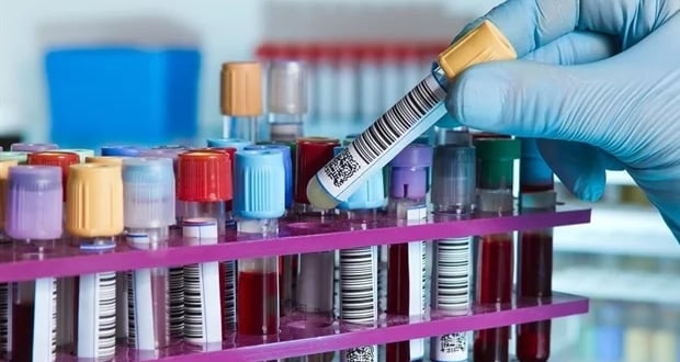 Autoimmune disease state samples
